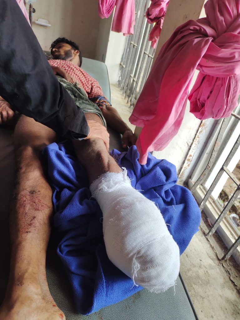 ফের মাইন বিস্ফোরণে নাইক্ষ্যংছড়িতে যুবকের পা বিচ্ছিন্ন